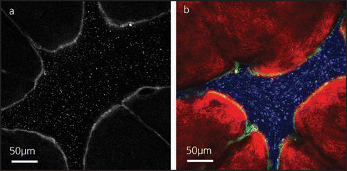 Figure 4 PLGA nanoparticles in human skin furrows 5 hours after administration. (a) A two photon micrograph at z = 15 µm subsurface depth showing superficial keratin fluorescence and clearly resolved single particles. (b) A pseudo-color overlay of two photon and confocal images at z = 28 µm revealing the release of a drug dummy from the particles and its cutaneous uptake. The two photon channel (green) shows keratinous layers and single particles, the 488 nm-excited confocal channel (blue) addresses the fluorescein-labeled particles solely and the 543 nm-excited confocal channel (red) exclusively shows the dummy compound (Texas Red) (published with permission from ref. 4).