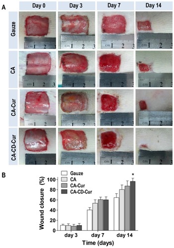 Figure 3 CA-CD-Cur–treated wounds showed accelerated wound closure compared to gauze-, CA-, and CA-Cur–treated wounds.