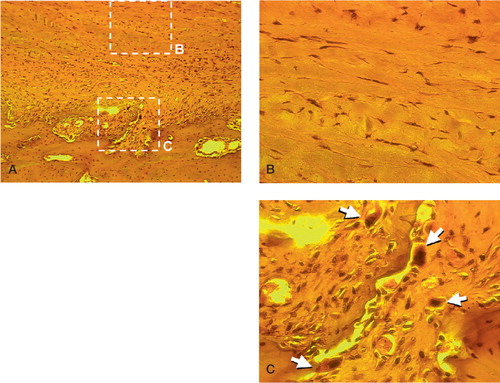 Figure 2. (A) Hematoxylineosin staining of bone-periosteum complex harvested from the proximal tibia of a 6-month-old rabbit (100 ×).(B) Histology of the fibrous layer in the periosteum (400 ×). Spindle-shaped fibroblasts were sparsely distributed in collagen matrix.(C) Histology of the cambium layer in the periosteum (400 ×). Osteoclasts (arrows) were found among dense osteoblast-like cells in the cambium layer.