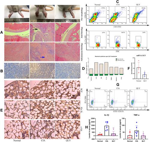 Figure 1 General effects of QLY treatment on CIA in rats. (A) Morphological observation of hind paws and historical examination of ankle joints/subcutaneous tissues, black arrow: cartilage erosion, blue arrow, rheumatoid nodules; (B) local expression of Th17α in the thymus assessed by immunohistochemical method; (C) distribution of CD3+CD4+IL-17α+ Th17 cells in peripheral blood evaluated by flow cytometry; (D) differentially expressed cytokines among different groups based on results from cytokine chip analysis; (E) protein expression of SCF, Flt-3L and c-kit in the marrow assessed by immunohistochemical method; (F) mRNA expression of SCF in marrow cells cultured in vitro evaluated by RT-qPCR; (G) distribution of inflammatory CD86+CD11b+ monocytes in peripheral blood evaluated by flow cytometry; (H) levels of IL-1β and TNF-α in the serum determined by ELISA. Statistical significance in image (H) *p < 0.05 and **p < 0.01 compared with CIA model rats; statistical significance in image F, *p < 0.05 compared with normal untreated cells.