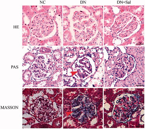 Figure 1. Effects of salidroside on the histopathologic changes of the kidney from rats with streptozotocin-induced DN (kidney tissue section, 400× magnification, scale bar = 50 μm). DN: diabetic nephropathy; DN + SAL: rats with DN treated with salidroside; HE: haematoxylin-eosin staining; NC: normal control; PAS: periodic acid-Schiff staining.