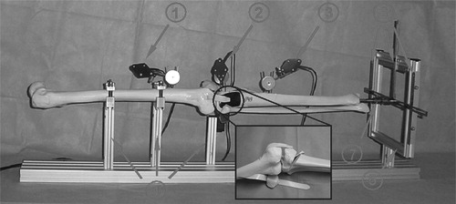 Figure 8. Test bench used for the evaluation of application accuracy, which consists of (1) the DRB of the femur, (2) the DRB of the proximal fragment, (3) the DRB of the tibia, (4) multi-freedom fixtures, (5) a measurement gauge that enables free movement of the distal tibia inside the frame, (6) rulers used to measure the position of the distal tibia, and (7) spherical joint used to connect the distal tibia with the measurement gauge.