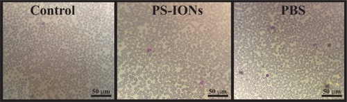 Figure 4 Light microscopy images (the total magnification was 400 times) of blood smear prepared samples from EDTA-anticoagulated blood without dilution (control) and after addition of PS-IONs (final concentration 200 μg/mL) and PBS after 4 h. The RBCs showed neither deformation nor aggregation when compared to the controls.