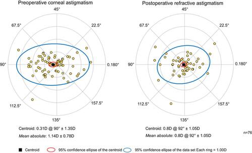 Figure 4 Double-angle plot showing preoperative and postoperative astigmatic vectors and their means and spread for the combined cataract surgery with trabecular microbypass–stent group.