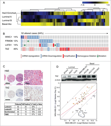 Figure 1. TAZ is highly expressed in basal/triple-negative breast cancer (TNBC) patients. (A) Heat map and heirarchical agglomerative clustering showing Hippo-FIN activity among different breast cancer subtypes using RNA-Seq data sets from a TCGA patient panel (n = 515 patients) that consists of basal-like, Her2 enriched, Luminal A and Luminal B BC subtypes using the PAM50-defined subtype predictor as a classification metric. (B) Alterations in the Hippo-FIN are mutually exclusive. Integrated analysis of mRNA, mutation and copy number events identify TAZ, FRMD6, LATS1 and WWC1 genes as deregulated in basal-like breast cancer tumors to a maximum p-value of 0.05 by Fisher's exact test. Tumor samples are shown in columns and genes in rows. Only samples with >4 % alterations are shown. Shown are genes with statistically significant levels of: (i) mutation (MutSig, false discovery rate <0.1) and mutation types, (ii) deletions and amplifications for genomic regions with statistically significant focal copy number changes (GISTIC2.0) and (iii) RNA expression level for selected genes, expressed as fold change from the median value for all patient tumor samples. (C) TAZ protein is highly expressed in triple-negative breast cancer (TNBC) TMAs. Representative examples of TNBC TMA are shown. Upper, H&E staining; bottom, IHC staining exhibiting high TAZ nuclear expression. (D) TAZ expression in different types of breast cancer cells was revealed by immunoblot. β-Actin was used as loading control. (Upper panel) A population of MDA-MB-231 cells was infected with a pooled shRNA library of a subset of Hippo pathway genes. Log2 median fold change in shRNA abundance of experimental or control (neutral) shRNAs at day 0 vs day 21 tumors (n = 3). The frequency of shRNA-encoding constructs was determined by deep sequencing. An enrichment score was calculated for each shRNA using the probability distribution of the rank product statistics for replicated experiments.