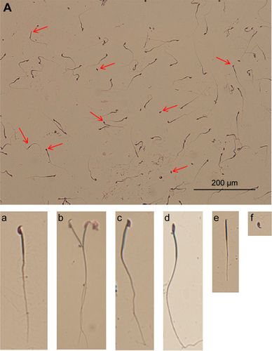 Figure S3 Picture of sperm morphologies.Notes: (A) Picture of sperm morphologies and abnormal sperm (red arrows). (a) Normal sperm. (b) Abnormal sperm with two heads and two tails. (c, d) Abnormal sperm with head deformities. (e) Abnormal sperm with no head. (f) Abnormal sperm with no tail.