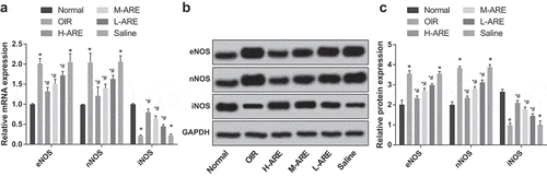Figure 7. iNOS expression was promoted while eNOS and nNOS were inhibited by Astragalus root extract in the retina of the OIR model mice. (a) The mRNA expression of eNOS, nNOS and iNOS in the retina of newborn mice of each group detected by RT-qPCR; (b) Protein bands of eNOS, nNOS and iNOS in the retina of newborn mice; (c) The protein expression of eNOS, nNOS and iNOS in the retina of newborn mice of each group detected by western blot analysis. The data in the figure are all measurement data, in the form of mean ± standard deviation, and the comparison among groups was analyzed by one-way ANOVA. The LSD-t-test was used for pairwise comparison after ANOVA analysis; * P < 0.05 vs. the normal group; # P < 0.05 vs. the OIR group, N = 10