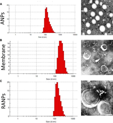 Figure 1 Size distribution and morphology of nanoparticles: Dynamic light scattering (DLS) size measurement and TEM image of (A) ANPs, (B) membranes, and (C) RANPs. Scale bar represents 100 nm.