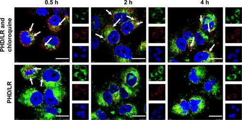 Figure 7 LSCM observation of PHD/LR intracellular release with or without the incubation of chloroquine at different time points.Notes: Green, red, and blue fluorescence indicates siRNA, endo/lysosomes, and nucleic acid, respectively. Scale bar =20 µm.Abbreviations: LR, lipoplex; LSCM, laser scan confocal microscopy; mPEG, methoxy poly(ethylene glycol); PHD, mPEG-PHis-PSD; PHis, poly(histidine); PSD, poly (sulfadimethoxine).