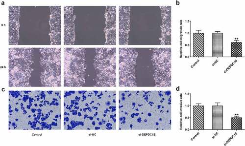 Figure 3. DEPDC1B knockdown inhibits the migration and invasion in HCC cells. (a-b) Relative cell migration rate of HCCLM3 cells in the control, si-NC and si-DEPDC1B groups was assessed by wound healing assay. **P < 0.01 (c-d) Relative cell invasive rate of HCCLM3 cells in the control, si-NC and si-DEPDC1B groups was determined by transwell assay. **P < 0.01.