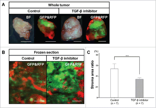 Figure 5. Color-coded imaging of resected tumors and frozen sections from TGF-β inhibitors-treated and control tumors. Bright-field and fluorescence images of whole tumors were obtained with the OV100 Small Animal Imaging System (A). Representative images of frozen tumor sections in both groups imaged with the FV-1000 confocal microscope (B). Bar graph shows the percentage of RFP stromal area determined from frozen-section imaging (C). ***P < 0.001. Scale bars: 5 mm in (A); 500 μm in (B). Error bars: ± SD.