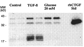 Figure 2. Qualitative analysis of CTGF protein and its induction in MC. Cells grown in a medium containing 5 mM glucose were serum-depleted and then cultured for an additional 48 hr in the presence of 2 ng/mL TGF-β or 20 mM glucose. Control cultures received fresh media containing 5 mM glucose, without added TGF-β. Conditioned media were pooled and heparin-sepharose purified, then immunoblotted using a polyclonal antibody raised against full length rhCTGF Citation[[24]]. Duplicate lanes represent media from different pools of media.