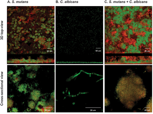 Figure 2. Morphogenesis of micro-colonies in 48-h biofilms (1% sucrose condition) In 1% sucrose condition, the 48-h biofilms were visualized by a two-photon laser confocal microscope. The biofilms of single species were shown in panel A (S. mutans) and panel B (C. albicans). The biofilms of duo-species (C. albicans and S. mutans) was shown in panel C. The confocal images indicate the cross-sectional and 3D-top views of biofilms; the green color indicates bacteria, and the red indicates the exopolysaccharides (EPS). Compared to the single species, the morphogenesis of C. albicans and S. mutans duo-species biofilms were significantly altered and characterized by formation of well-structured microorganism cluster enmeshed with EPS. These clusters are defined as microcolonies. In the biofilm formed by C. albicans alone, no microcolonies defined as above were identified.