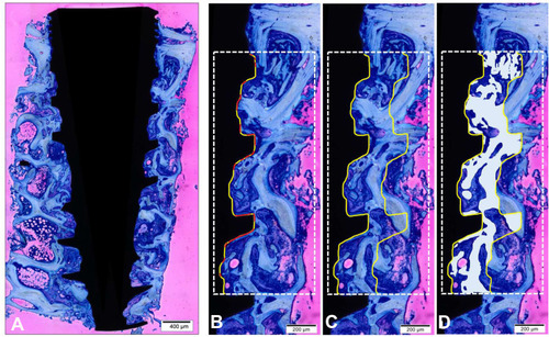 Figure 2 Histomorphometry for bone-implant contact and (BIC) and bone area formation (BAFO) analysis. (A) Histological reconstruction of the implant and adjacent bone area; (B) determination of the line of interest for BIC; in the long implant axis, the implant profile design was drawn from the first thread of the implant to the beginning of the fourth thread (yellow line) and direct bone-implant contact (red line); (C) determination of the area of interest for BAFO. An identical line of implant profile design was duplicate and aligned at a distance of 270 µm at the horizontal plane (total area); (D) the bone area formation (BAFO) manually determinates for posterior analysis (total area/BAFO) (%). Stain: Toluidine Blue and Acid Fuchsin stained. Scale bar: (A) 400µm; (B,C and D) 200µm.