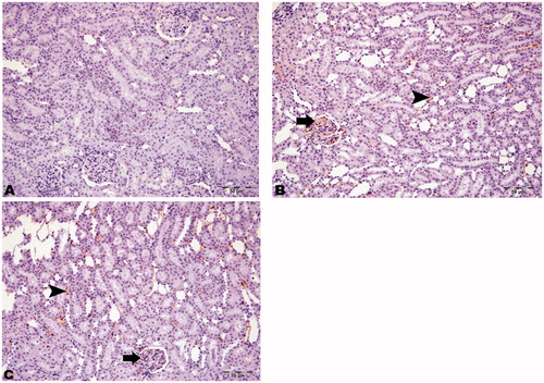 Figure 6. Immunohistochemical staining of LC3B in rat kidney (200×). (A) HRs showed no immunopositivity, (B) DRs showed moderate immunopositivity in intertubular areas (arrowhead) and glomeruli (arrow), and (C) DRs + CN showed severe immunopositivity for LC3B in intertubular areas (arrowhead) and glomeruli (arrow).
