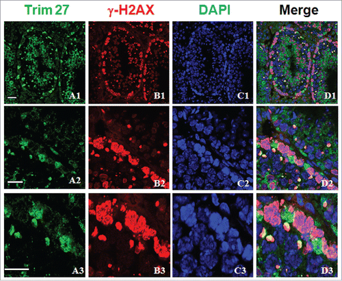 Figure 3. Co-localization of Trim27 and γ-H2AX in testis sections. Upper panel: Trim27 (green), γ-H2AX (red) and nuclei(blue) at low magnification. Lower panel: Trim27 (green), γ-H2AX (red) and nuclei (blue) at high magnification. Trim27 is co-localized with γ-H2AX in the nuclei of spermatocytes at the zygotene stage, and in the XY bodies of pachytene spermatocytes. Bars = 10 μm.