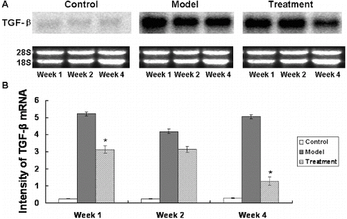 Figure 1. Northern blot analysis of the TGF-β expression at the mRNA level. Pulmonary tissues of the control group, the model group and the treatment group were collected at week 1, week 2 and week 4 after modelling. Total RNAs were extracted from these pulmonary tissues for northern blotting analysis. (A) Representative results of northern blots probed with TGF-β; ethidium bromide staining of 18S and 28S rRNA indicated the integrity and equal gel loading of RNA. (B) Quantitative northern blots results of TGF-β intensity. Compared with the model group, *P < 0.05.