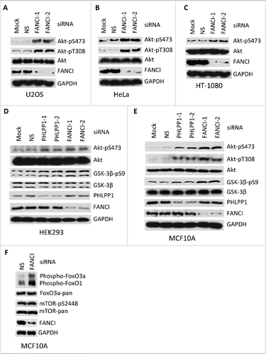 Figure 2. Depletion of FANCI by siRNA induced spontaneous phosphorylation of Akt at S473 and T308. (A-F) Immunoblots of Akt, GSK-3β and FoxO in human nontransformed and cancer cell lines upon FANCI depletion. FANCI-1, FANCI-2, PHLPP1-1 and PHLPP1-2 indicate distinct siRNAs. NS indicates a control siRNA. GAPDH indicates a loading control.