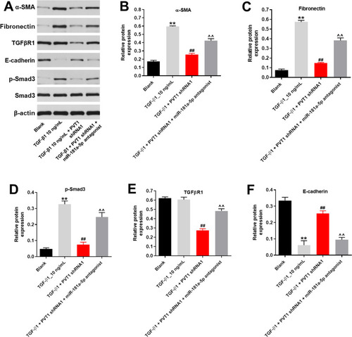 Figure 4 MiR-181a-5p antagonist significantly reversed the anti-fibrotic effect of PVT1 knockdown in vitro. (A) The protein expressions of α-SMA, Fibronectin, TGF-βR1, E-cadherin, p-Smad3 and Smad3 in HK-2 cells were measured by western blot. (B) The relative protein expression of α-SMA was quantified by normalizing to β-actin. (C) The relative protein expression of Fibronectin was quantified by normalizing to β-actin. (D) The relative protein expression of p-Smad3 was quantified by normalizing to β-actin. (E) The relative protein expression of TGF-βR1 was quantified by normalizing to β-actin. (F) The relative protein expression of E-cadherin was quantified by normalizing to β-actin. **P < 0.01 compared to Blank, ##P < 0.01 compared to TGF-β1, ^^P < 0.01 compared to PVT1 shRNA1.