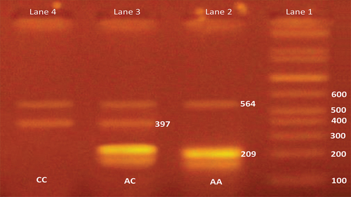 Figure 1. Agarose gel electrophoresis of FOXP3 (rs 3,761,548) gene.