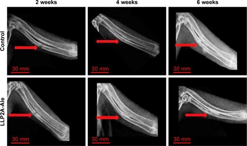 Figure 1 X-ray images showing LLP2A-Ale accelerates bone rabbit bone healing. X-ray films of the course of fracture healing at 2, 4 and 6 weeks after treatment in each group. The red arrow points to the fracture line.