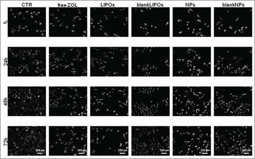 Figure 5. Representative time-lapse images of DU 145 cells for a qualitative comparison of ZOL delivery systems. Pictures were taken at 24 h intervals over 72 h. LIPOs seemed to act as the stronger anti-proliferative agent if compared to NPs and free ZOL. Scale bar, 100 μm.