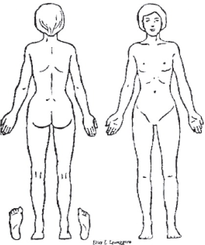Figure 13. Pain diagram. The patients were asked to draw crosses to describe and localize their pain.
