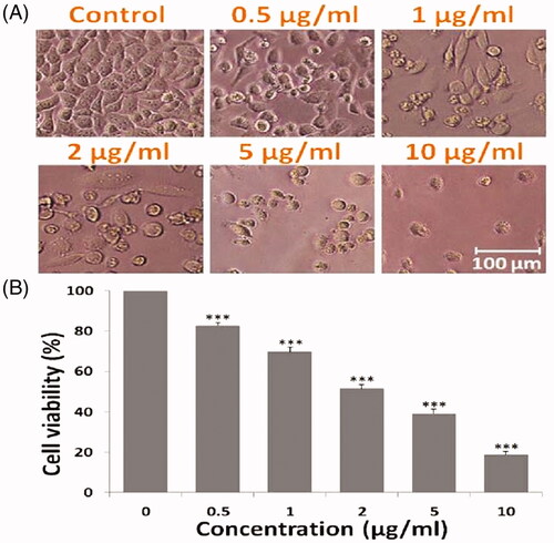 Figure 5. Anti-proliferative effect to DOX SNEDDS against HepG2 cells of human liver carcinoma. (A) Showing morphological changes in HepG2 cells after treated with 0.5, 1, 2, 5 and 10 µg/ml concentrations of DOX SNEDDS. (B) Graph representing the % cell viability of HepG2 cells after treated with various concentrations (0.5, 1, 2, 5 and 10 µg/ml) of DOX SNEDDS.