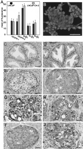 1 Expression of VEGF/VEGF receptors and integrins. (A) Cells were stained with specific mAbs for 60 min on ice, washed by centrifugation, incubated with secondary antibodies, washed again and surface expression was analyzed by FACS. Fluorescence in the presence of secondary antibodies was subtracted. (B) LNCaP-C4 cells were fixed and stained for VEGFR-2 expression (second antibodies were labeled with FITC). Nuclei were stained with DAPI. (C-H) Tissue sections of normal prostate (C&D), prostate tumor (E, F), and bone metastasis (G, H) were stained with antibodies against VEGFR-2 (C, E, G) and α5β1 (D, F, H), respectively, then with secondary abs (ABC kit from Vector). (I and J). Sections of prostate cancer (I) and bone metastasis (J) were stained with primary antibody against human VEGF, then with secondary antibody (Vector). The signal was visualized by DAB (Vector). Scale bar = 20 μm. (See Color Plate I).