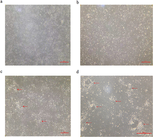 Figure 1 States of MDBK cells by BoHV-1 infection at different points in time. (a) MDBK cells uninfected with BoHV-1 were used as a negative control; (b) MDBK cells post-infection 18 h, characterized by focal rounding; (c) MDBK cells post-infection 24 h, detachment of cells from the surface of the cell-culture dish; (d) MDBK cells post-infection 33 h, aggregation of the cells into vacuoles. All cell morphology under the light microscope in multiple rate 100-fold. Arrows indicate the state of cytopathic effects (CPE).