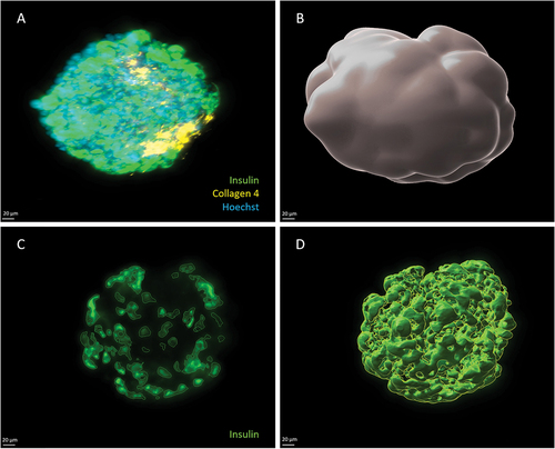 Figure 5. Digital Image Analysis process. (a) 3D projection of an islet before processing; (b) 3D projection of a region of interest, used to calculate total islet volume. (c) 2D projection showing target protein (insulin) identified using a standardized intensity threshold; (d) 3D projection of the target protein stained volume.