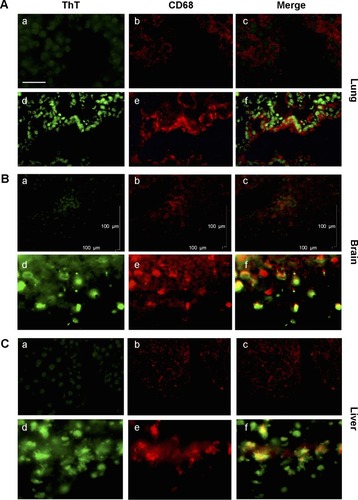 Figure 5 Association between amyloid fibril deposits and macrophage recruitment.Notes: ThT and anti-CD68 antibody staining revealed co-localization between macrophages and amyloid fibril deposition. In the lung (A), brain (B), and the liver (C) from MWCNT-exposed mice, with respect to the controls (a–c), increased numbers of macrophages are evident in exposed animals (d–f), which are associated with areas of amyloid deposition. The scale bar for all photographs =100 µm.Abbreviations: ThT, Thioflavin T; MWCNT, multi-wall carbon nanotube.