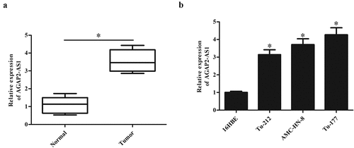 Figure 1. AGAP2-AS1 expression in clinical tissues and cell lines. (a) The expression levels of AGAP2-AS1 were evaluated by qRT-PCR in 23 paired LSCC tissues and adjacent non-tumor tissues. (b) AGAP2-AS1 expression in the normal bronchial epithelial cell line 16HBE and LSCC cell lines including Tu-212, AMC-HN-8 and Tu-177 cells. * p < 0.05.