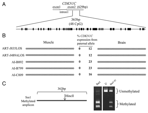 Figure 6. Imprinted expression of CDKN1C is not regulated by somatic DNA methylation. (A) Shown on top is a depiction of the first two exons and the first intron of the maternally-expressed gene CDKN1C. No DNA polymorphisms were identified in this region. Bisulfite converted specific primers for a 363 bp region of the exon 2 were used to determine the DNA methylation status of 48CpG sites (ovals). (B) The PCR product was sequenced without cloning. Two tissues from five fetuses are shown. Filled and open circles represent methylated and unmethylated CpG dinucleotides, respectively. Each line denotes the DNA methylation pattern of each sample. Only the first 39 CpGs are shown here because of the low quality sequencing of last 9 CpGs due to primer binding. The level of paternal CDKN1C expression is shown in the center and next to the strands (based on a SNP in exon 4). (C) COBRA performed to ensure ability of primers to equally amplify methylated and unmethylated alleles. The restriction enzyme HincII recognized and cleaved the methylated amplicon. Sss1 = genomic DNA co-incubated with the methyltransferase Sss1 prior to bisulfite conversion, U = bisulfite converted DNA with no Sss1 treatment, Sss1 + U = equal portions of methylated and unmethylated DNA were used for PCR amplification. The digested products were resolved by PAGE.