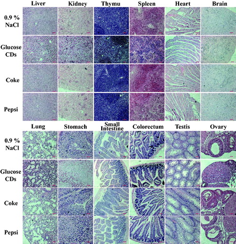 Figure 4. Representative H&E stained images of major organs, including liver, kidney, thymus, spleen, heart, brain, lung, stomach, small intestine, large intestine, testis and ovary for mice treated with NPs from Coke and Pepsi at a dose of 2 g kg−1 body weight at 24 h. The control group mice were orally administrated 400 µL of a 0.9% NaCl and artificially synthesized glucose CDs (2 g kg−1 body weight) aqueous solution. Scale bar =100 μm.