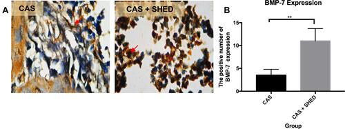 Figure 3 The periodontal tissue histological section of an afflicted subject. (A) AbMo and DAB were used to perform immunohistochemical analysis of BMP-7 expression. Positive cells appeared brown in color (red arrow) through a light microscope at 1000x magnification. (B) The number of positive expressions of BMP-7 is shown. The statistical significance of differences between groups was examined by means of an unpaired t-test (n = 7; **Information: significant at p < 0.01).