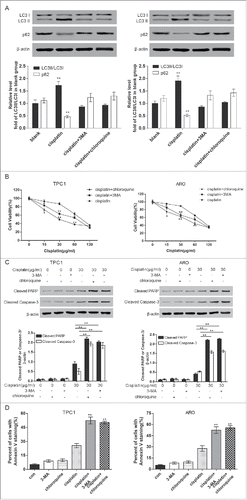 Figure 4. Autophagy inhibitors 3-methyl adenine (3-MA) and chloroquine promoted apoptosis of ATC cells. A. Western blot assay results suggested that 3-MA and chloroquine significantly suppressed cell autophagy. **P < 0.01, compared with the level of LC3 II/LC3 I ratio of blank group. MTT assay displayed that the cell viabilities of the 3-MA and chloroquine group were significantly down-regulated after ARO and TPC1 cells were treated with cisplatin. *P < 0.05, **P < 0.01, compared with the cisplatin group. C. Western blot displayed that the expression of cleaved caspase-3 and PARP were significantly increased in the 3-MA and chloroquine group after ARO and TPC1 cells were treated with cisplatin. **P < 0.01, compared with the cisplatin group. D. Flow cytometric analysis displayed that the percent of cells with Annexin V staining was significantly higher in 3-MA and chloroquine group. **P < 0.01 compared with the cisplatin group. ATC: anaplastic thyroid carcinoma.