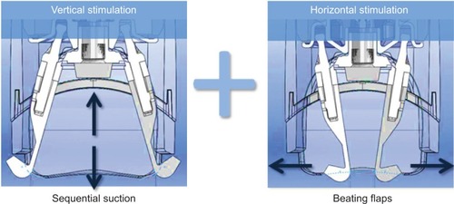 Figure 2 Double stimulation.