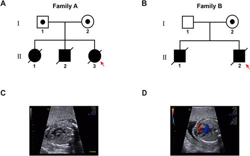 Figure 1 Families’ pedigree and ultrasonic image. (A and B) Family A and B’s pedigree. Males are indicated by squares and females by circles. Black solid indicates individuals with a congenital heart defect, and symbols with a slash through them indicate deceased individuals. The black solid circle in the hollow square and circle indicates individuals with variant carrier. The proband is indicated with a red arrow. (C and D) The heart ultrasonography of the family B’s proband.