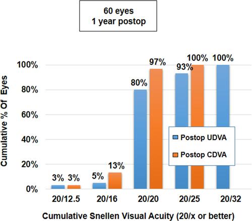 Figure 3 Histogram showing uniocular results for UDVA (n=60 eyes) and CDVA obtained following implantation of AT LARA EDoF IOL at 12 months postoperatively.