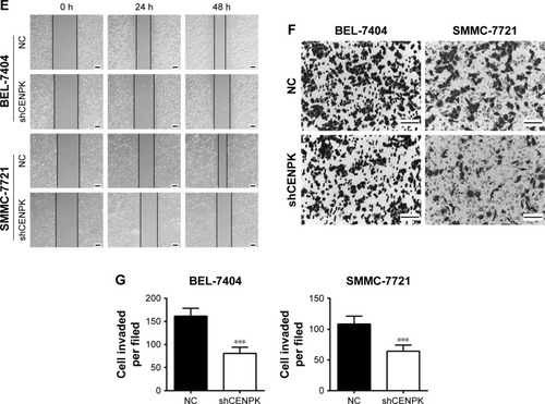Figure 2 Silencing of CENPK inhibits HCC cell growth, migration, and invasion in vitro.Notes: (A) Expression of CENPK in BEL-7404 and SMMC-7721 cells was confirmed by qRT-PCR and Western blotting after transfection with shCENPK lentivirus or shNC. (B) Proliferation rate of BEL-7404 and SMMC-7721 cells was measured over 4 days by the CCK-8 assay. (C and D) Representative images (C) and quantification (D) of the colony formation assays are shown for BEL-7404 and SMMC-7721 cells. (E) Analysis of migration in BEL-7404 and SMMC-7721 cells as measured by wound healing assays (×200). (F and G) Analysis of invasion in BEL-7404 and SMMC-7721 cells as measured by transwell assays. (F) Representative photographs (×200). (G) Number of invaded cells was counted in five randomly selected areas. Scale bar =100 µm. NC represents negative control group (shNC), and shCENPK represents downregulation of CENPK group. *P<0.05, **P<0.01, ***P<0.001.Abbreviations: qRT-PCR, quantitative real-time PCR; CCK-8, Cell Counting Kit-8; NC, negative control.
