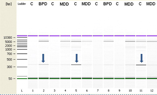 Figure 3.  Genotyping for large common deletion. Subjects were genotyped in duplicate at two concentrations. Arrows indicate presence of deletion relative to 5000 bp upper non-deleted band. Group abbreviations are shown in Table I.