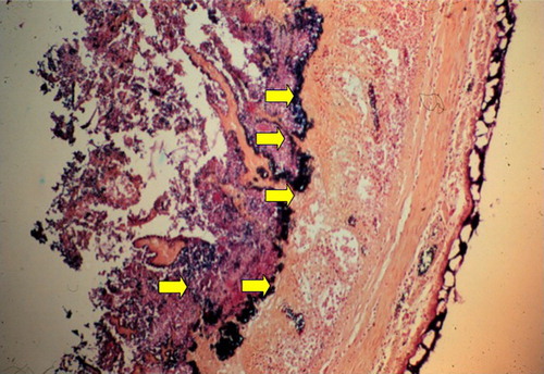 Figure 3. Gram-stained histological section of the jejunum of a chicken with NE, photographed at about 40×. A hallmark of the histopathology of the small intestine of chickens with NE is the large number of C. perfringens (dark-blue bacteria, indicated by the yellow arrows) that are present deep in the submucosa after the more superficial mucosa has become necrotic and has sloughed off. The numerous extracellular matrix proteins exposed by the NetB-induced damage are likely the target receptors for different bacterial adhesins that must allow C. perfringens to adhere in such a characteristic manner.