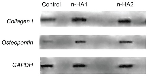 Figure 9 Collagen I and osteopontin synthesis by MG-63 cells cultured with the control, n-HA1, and n-HA2 were determined by Western blotting. Similar results were obtained in four separate experiments.Abbreviation: n-HA, nanohydroxyapatite.