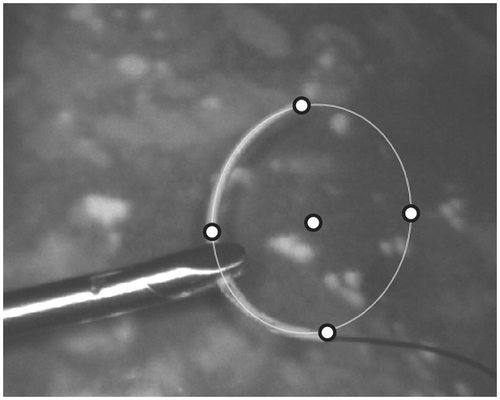 Figure 6. The five points used for establishing the homography between the ellipse and the needle model.