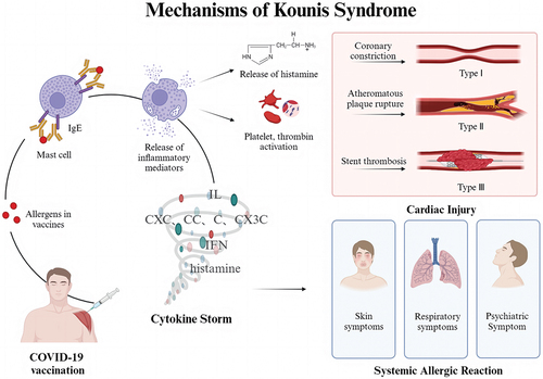 Figure 2. Schematic mechanism of kounis syndrome induced by COVID-19 vaccination.