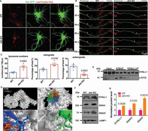 Figure 5. Lysosome trafficking was abnormal in atm−/− cells. (A) LysoTracker-Red (red) staining of WT and atm−/− (atm KO) cortical neurons transfected with pAAV-SYN-EGFP (green, Addgene, 50,465; Bryan Roth). (B) Time-lapse images of transfected WT and atm−/− cortical neuron neurites. (C) Quantification of total lysosome numbers (left), the percentage of lysosomes moving in retrograde (middle) and anterograde (right) directions. Error bars = SEM; n = 4 batches of cultures; p values are as marked (unpaired t test). (D) Models of the predicted atomic interactions between ATM (white, PDB ID: 5NP1) and DYNLL1 (rainbow, PDB ID: 3RJS), shown with intermolecular hydrogen bonds (pink dashed lines). (E) Representative blots of DYNLL1 and p-[S/T]Q (ATM substrate) with ATM and DYNLL1 immunoprecipitates in WT cortex lysates. (F) Western blots of DYNLL1 (dynein light chain1), DNAH (dynein heavy chain), DNAIC (dynein intermediate chain) and LAMP1 in isolated lysosomes from WT and atm−/− mouse cortical lysates. (G) DYNLL1, DNAH (dynein heavy chain), DNAIC (dynein intermediate chain) protein levels normalized to LAMP1 in isolated lysosomes from both WT and atm KO cortex. Error bars = SEM; n = 4 batches of cultures; p values are as marked (unpaired t test)