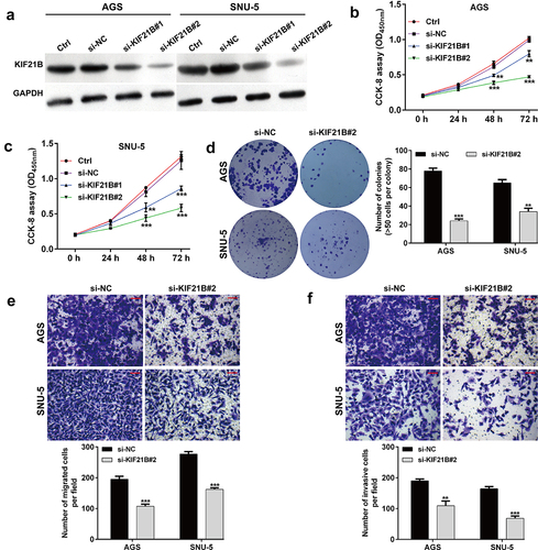 Figure 3. Effects of KIF21B knockdown on cell proliferation, migration and invasion in GC cells. (a) Western blot analysis was performed to detect KIF21B protein expression in AGS and SNU-5 cells after transfection with si-NC, si-KIF21B#1 or si-KIF21B#2 for 48 h. (b-c) CCK-8 assay was used to evaluate cell proliferation ability in AGS and SNU-5 cells. (d) Colony formation was assessed in AGS and SNU-5 cells. (e) Cell migration and (f) invasion in the analyzed groups. Magnification, ×200; scale bar, 100 μm. All data are expressed as the means ± SD. **p < 0.01, ***p < 0.001, compared with si-NC group.