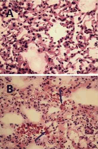 Figure 9.  Photomicrographs of lung tissue sections (×400▪A for control group and B for microsphere group).