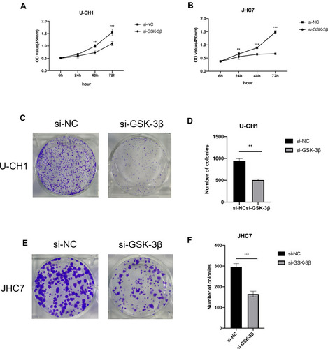 Figure 3 Silencing of GSK-3β inhibits the proliferation of chordoma cells in vitro. (A and B) CCK-8 assays were conducted to test the proliferation ability of U-CH1 and JHC7 cells transfected with si-GSK-3β. (C and E) The colony formation assay was used to analyze the proliferation ability of U-CH1 and JHC7 cells transfected with siRNA. (D and F) The numbers of cell clones. All experiments were conducted triple times. **p < 0.01; ***p < 0.001.